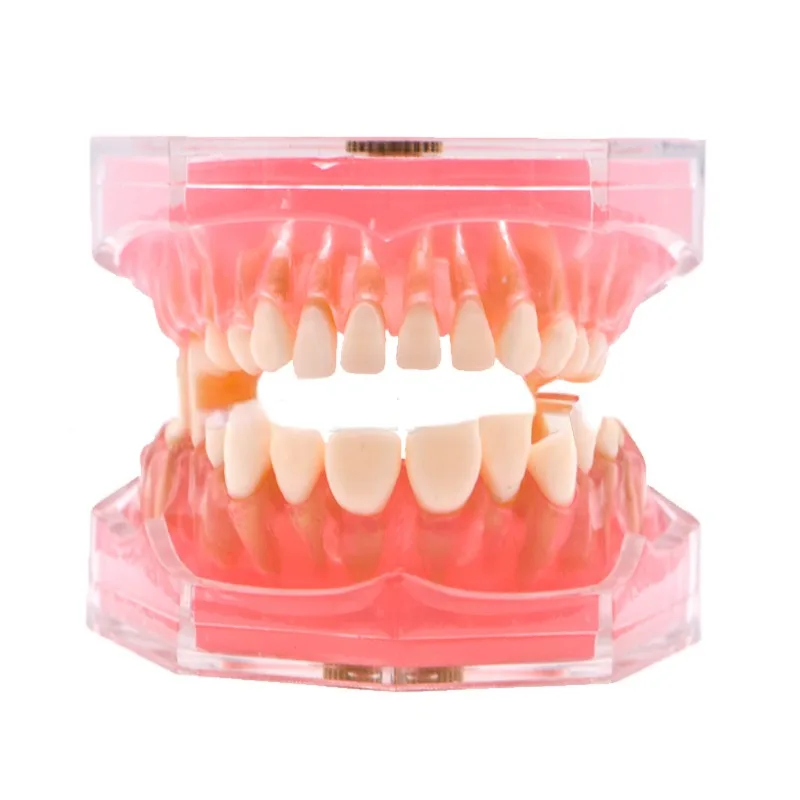 Modelo de enseñanza Dental estándar, soporte suave Dental extraible, Typodont 1:1, mandíbula de goma de demostración, estomatología extraíble