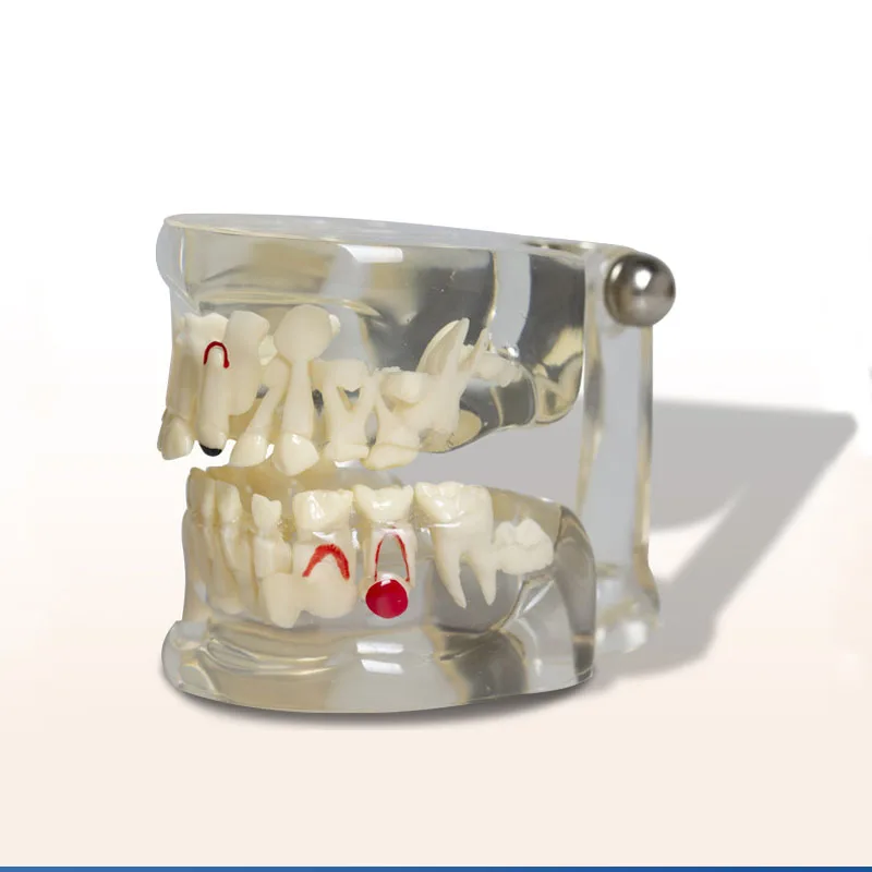 

Deciduous Tooth Permanent Teeth Alternating Study Dental Model For Children Teathing Pediatric Dental Pathology Preventive Model