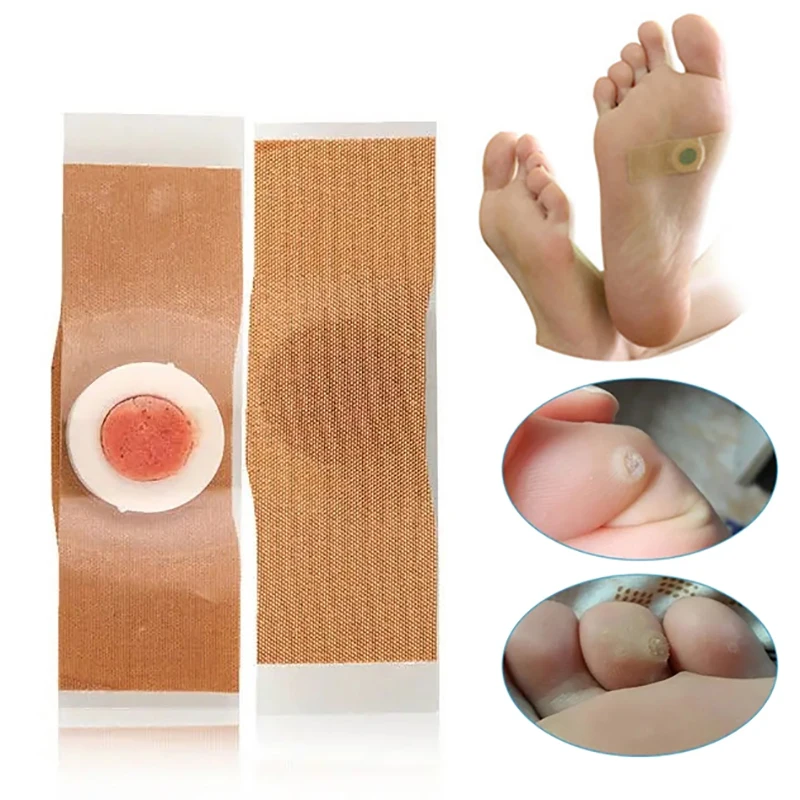 50/100 unidades de parches para eliminación de callos y durezas, pegatinas en blanco para callos, parches de fijación DIY, parches de acupuntura para el cuidado de los pies