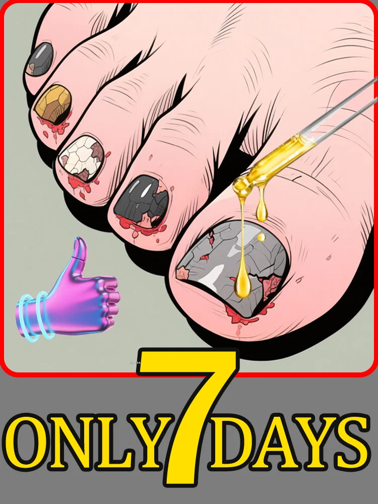 Schnell und harmlos – 100 % wirksam bei der Behandlung von Onychomykose. Schnell und harmlos