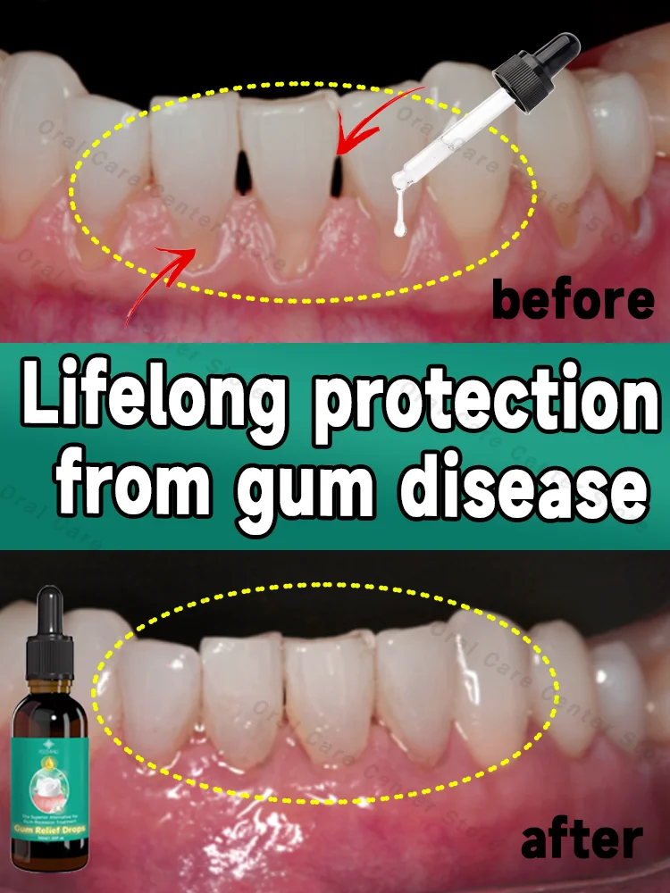 Effectively repair damaged gums, relieve toothache, strengthen teeth and strengthen gums