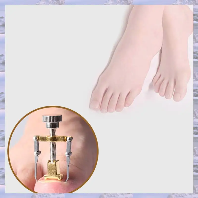 2025-Eingewachsene Zehennägel Zehennagelpflege-Werkzeug Professionelles Feilenkorrekturgerät Pediküre Fuß Bunion Corrector Protector