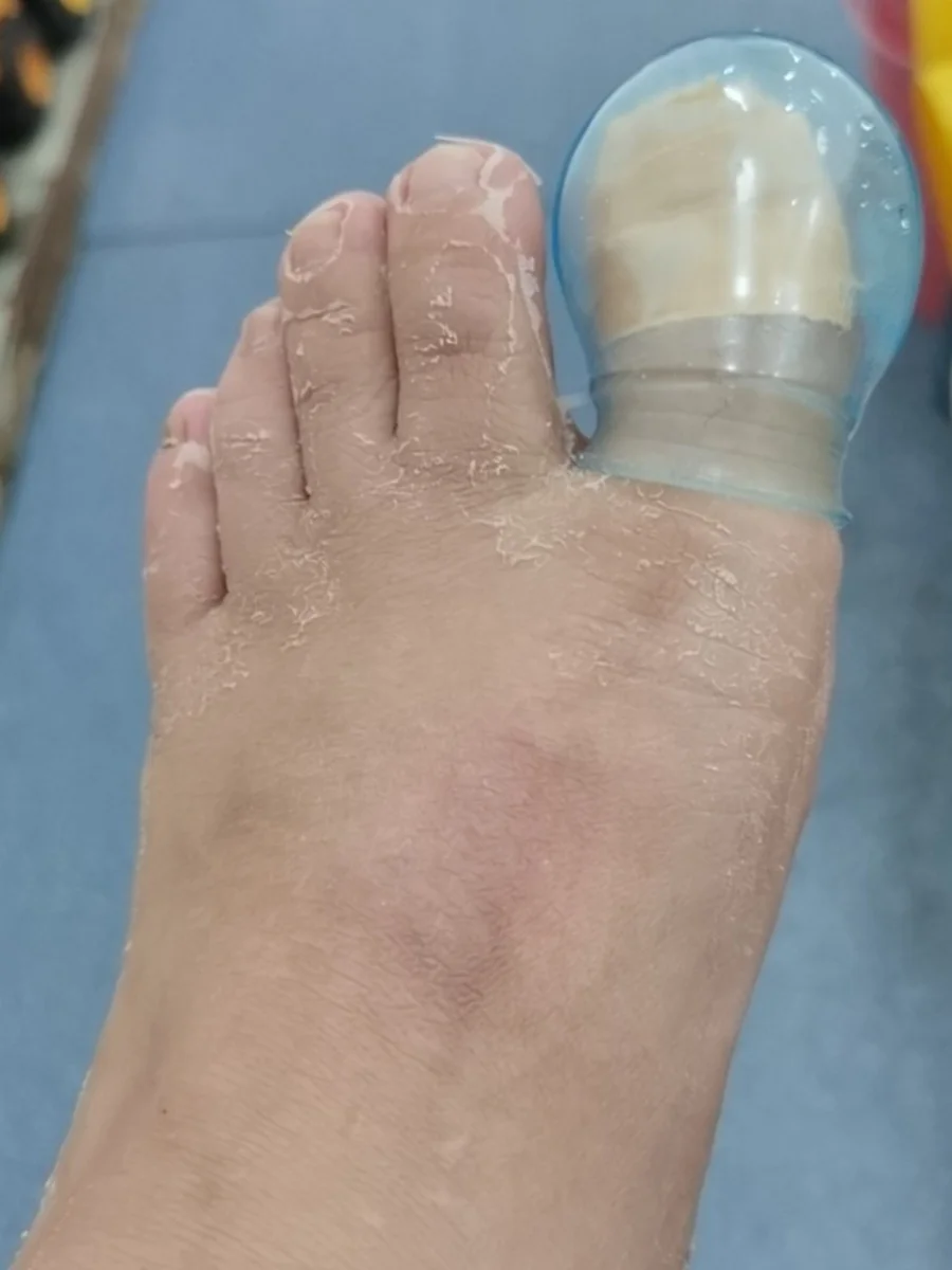 

Waterproof Thiened Bathing Finger Covers ey Nail Mediion Bathing Tools Non-Disposable Personal Hygiene Accories