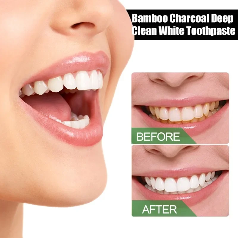 Bamboo Charcoal Deep Teeth Whitening Toothpaste remove yellow tartar Teeth Stains Brighten White Oral Odor fresh breath gum Care