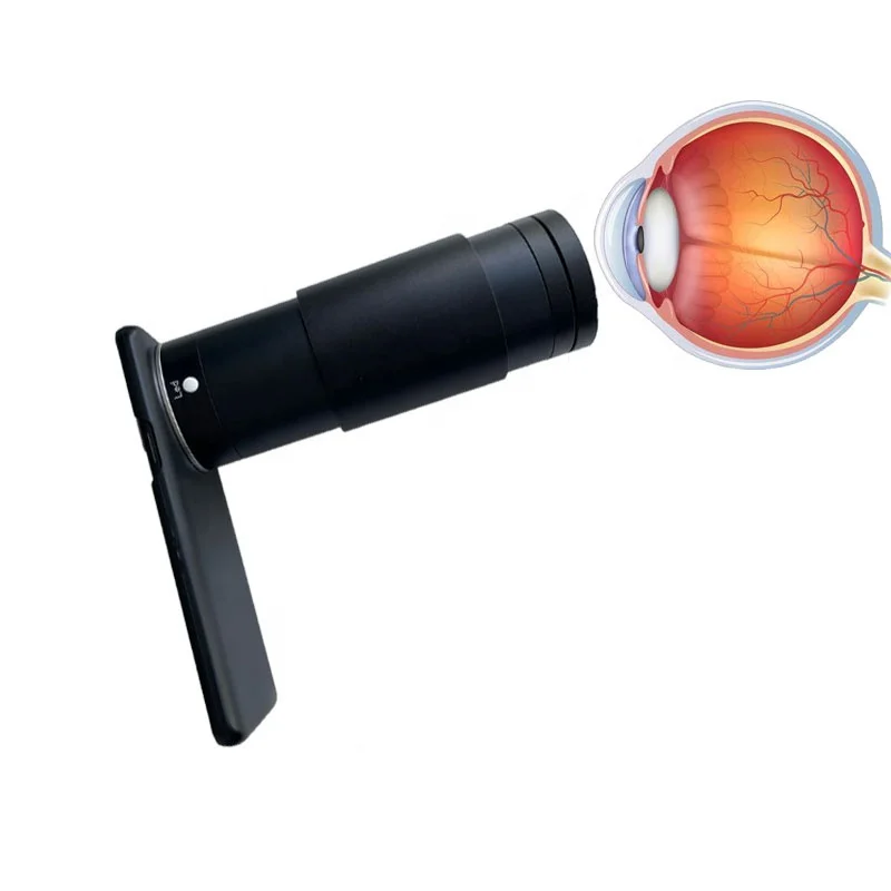 Câmera retinal portátil digital, câmera de fundo ocular, preço, smartphone, oftalmologia, equipamento oftálmico