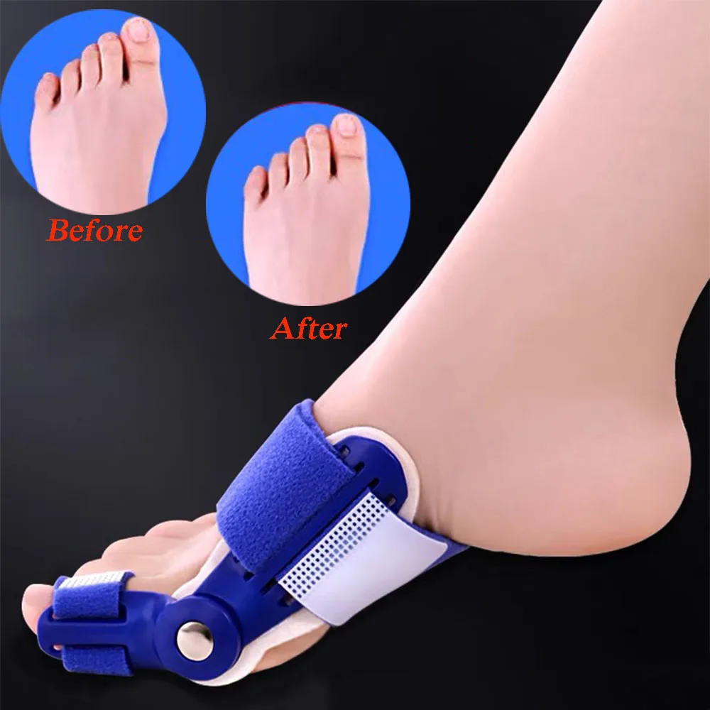 Professional Hallux Valgus Corrector Toe Separator For Unisex Pain Relief Bunion Corrector Big Toe Straightener Orthopedic Tool