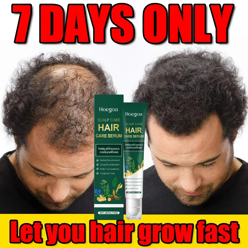 

7-дневная сыворотка для быстрого роста волос с имбирем, против выпадения волос, сыворотка для восстановления поврежденной кожи головы, питательные средства по уходу для женщин и мужчин