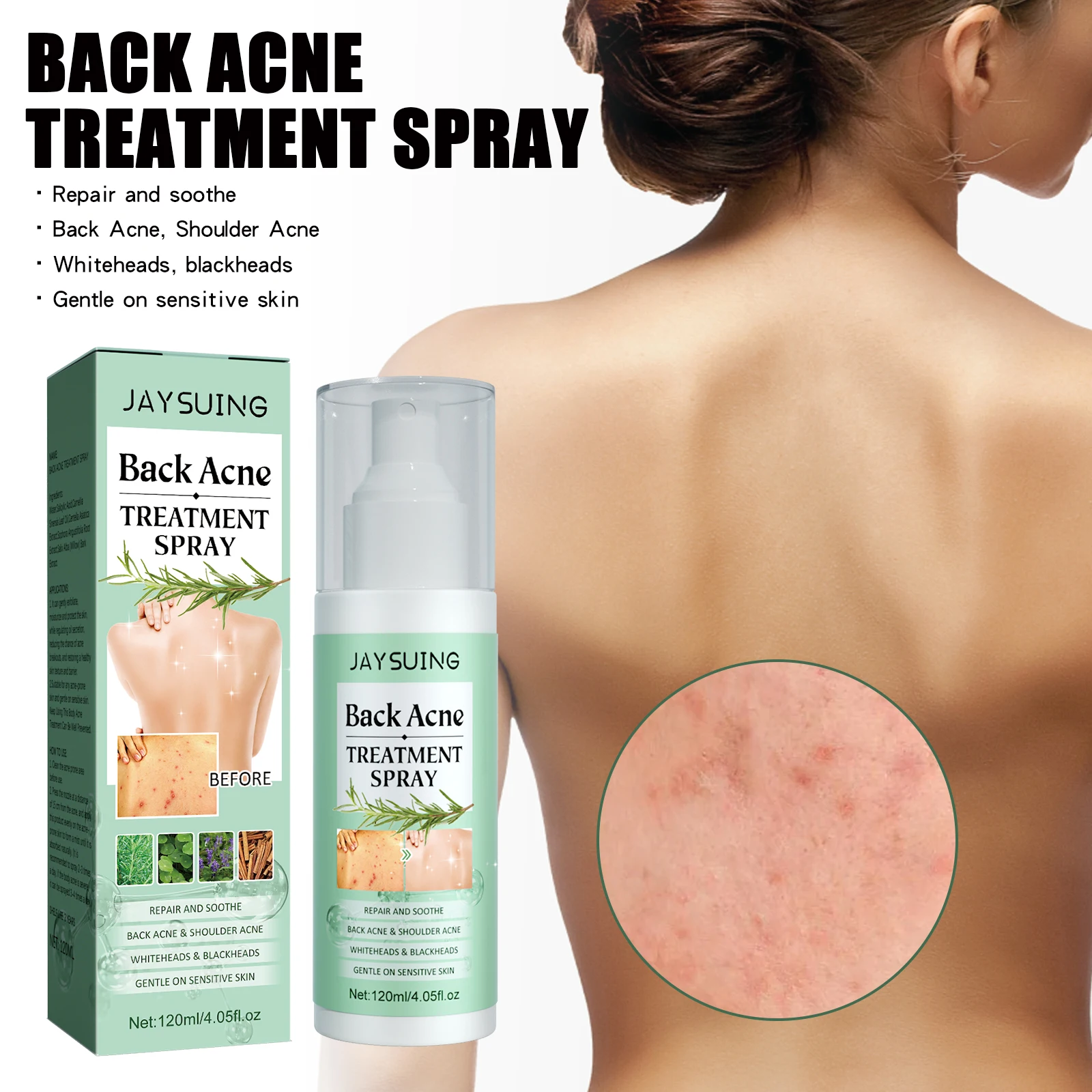 

Back Acne Repair Spray Fade Scars and Nourish Skin Moisturizing and Soothing Body Care Set with Deep Cleansing and Oil Control