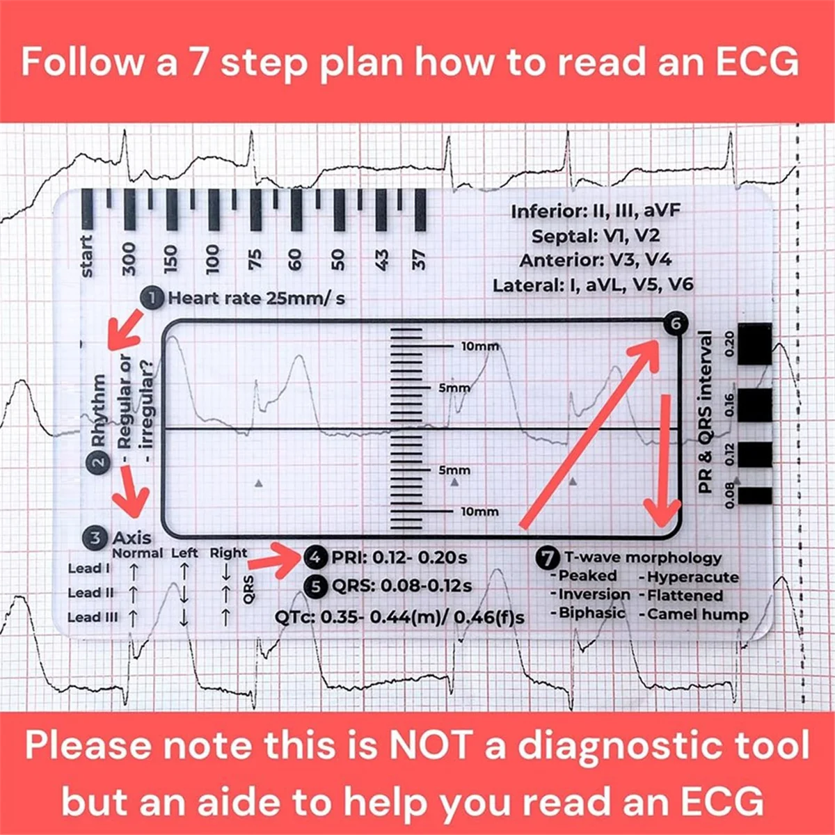 AT77 ECG 7 Step Ruler, ECG 7 Step Ruler for ECG/EKG Interpretation, Rapid and Quick Cardiac Analysis and Measurement Tool