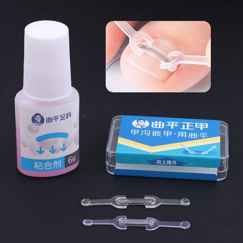 Nagelverzorging Ingegroeide teennagel Correctie Ingegroeide teen Nagelbehandeling Elastische patch Sticker Rechttrekken Clip Brace Pedicure Tool