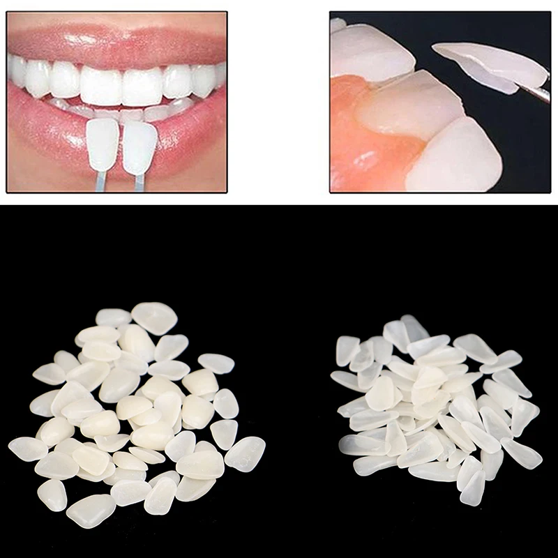 60PC Dental Ultra-Thin Whitening Veneers Resin Porcelain Materials Temporary Teeth Upper Anterior Whitening Dental Film(No Glue)