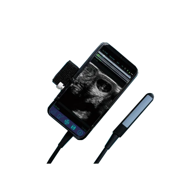 Rectal Linear Probe Veterinary Diagnostic Ultrasound System