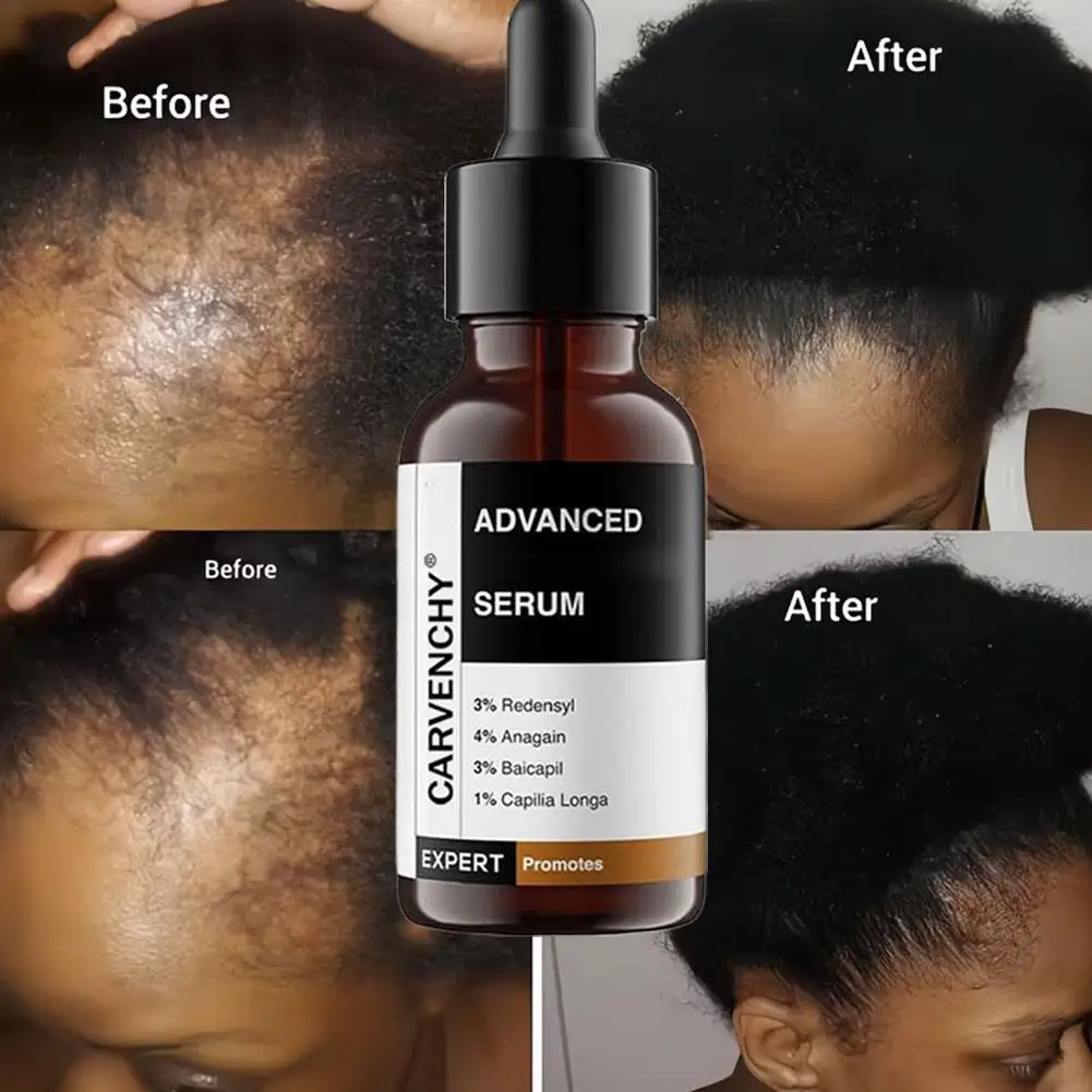 Meisaar-tratamiento de cabello orgánico 100% de etiqueta privada, suero de aceite para el crecimiento, biotina, romero, arroz hidratante para hombres y mujeres Z9I5