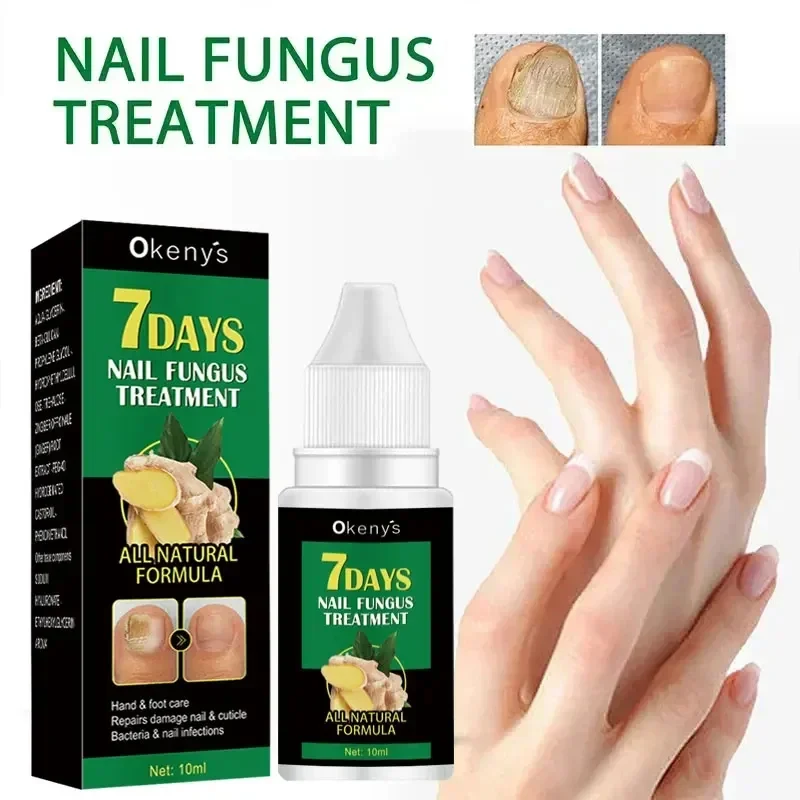 Extra Strong Nail Fungus Treatment Serum Essence oil Feet Nails Repair Care Essence Cream Anti Infection Toe Fungal Removal