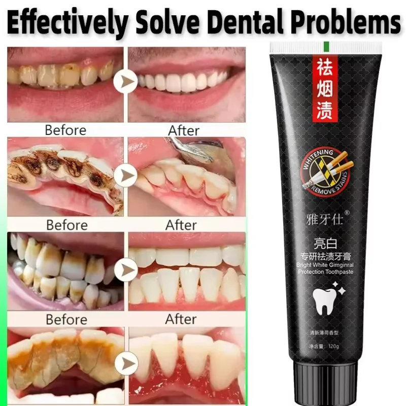 Fast Remove Smoke Stains Toothpaste Teeth Whitening Pen Remove Plaque Stain Oral Hygiene Cleaning Fresh Breath Dental Tools 120G