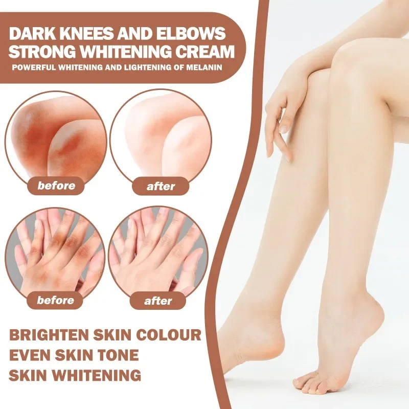 Body Whitening Cream Private Part Underarm elbow joint Bleach Whiten Knee Brighten Inner Thigh Intimate Dark Remove Melanin Skin