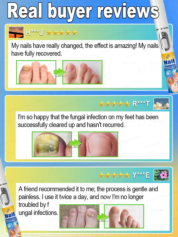 تساعدك على التخلص من فطار الأظافر. حل مشاكلك بالطرق العلمية. #5