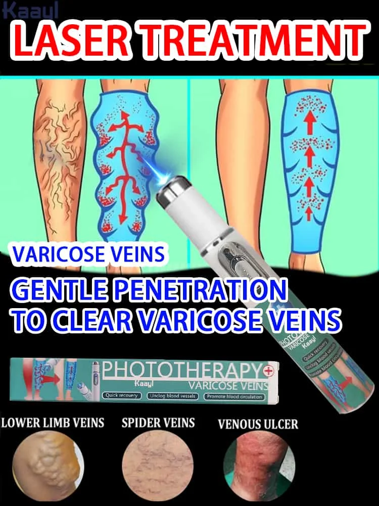 

Vein Laser