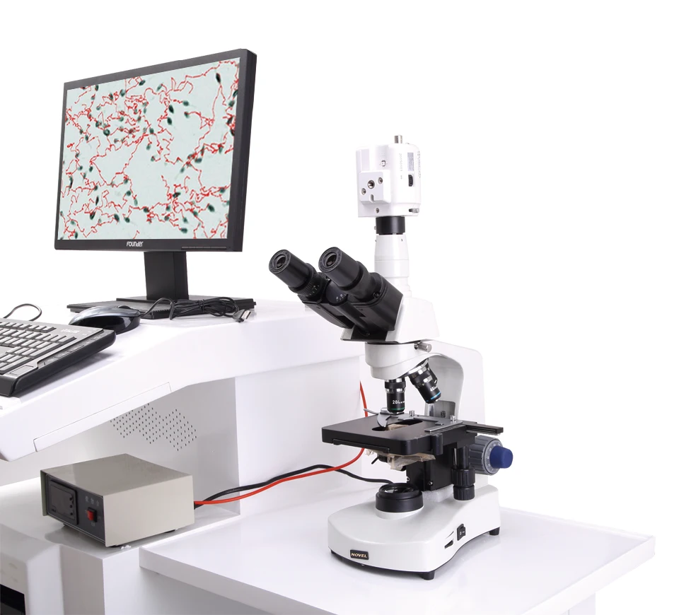 Computer assisted semen analysis