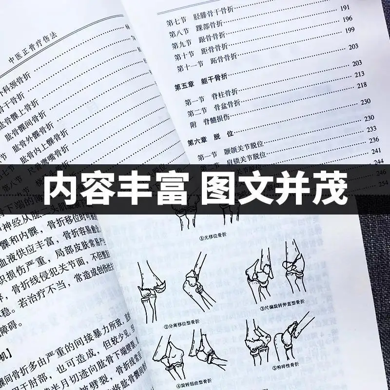 Traditional Chinese Medicine Bone-setting Therapy Graphic Illustration of Bone-setting Manipulation Bone Injury Treatment Books