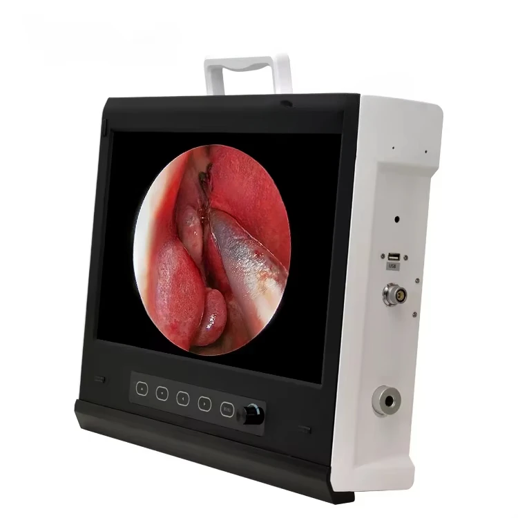 IKEDA 1920*1080P Full HD Portable ENT/Urology/Hysteroscopy/Laparoscopic  With Video Recorder