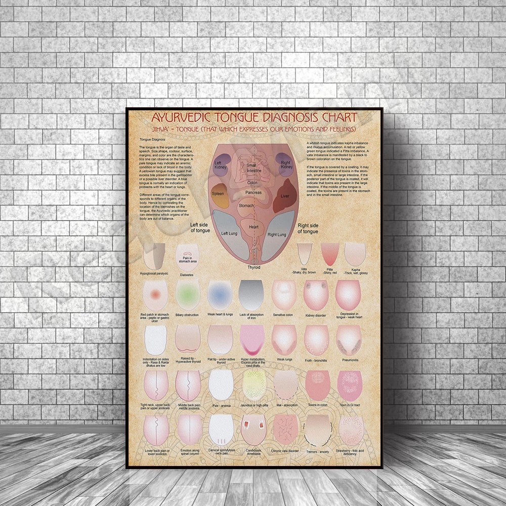 Ayurveda Zunge Diagnose Diagramm Vertikale Poster, Zunge Gesundheit Wand Kunst, Ayurveda Healing Wand Dekor