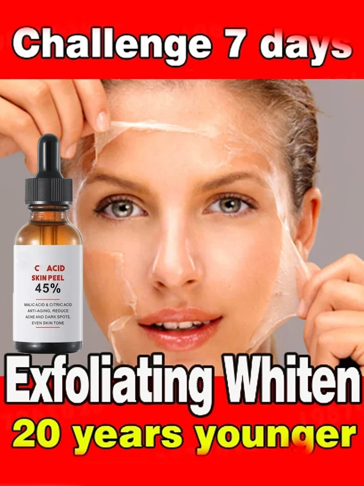 Yellow Peeling Oil Bleaching Dark Skin Spots Remove Dead Skin Lighten Melanin Scrub Exfoliating Whiten Moisturize Face Skin Care