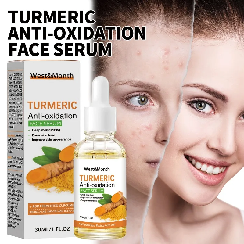 

Turmeric Anti-Oxidation Face Serum Refreshing Nourishing Moisturizing Repair Skin Brighten Fade Dark Spot Essence Acne Care