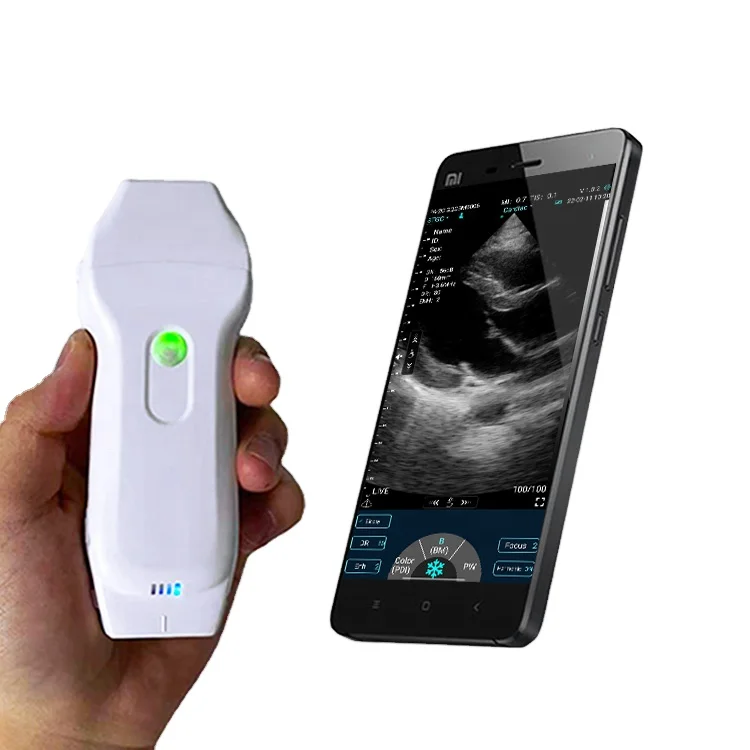 Double Head Wireless Ultrasound Probe Portable Doppler Ultrasound Phased and Linear Wireless Ultrasound Scanner CE D3 3 Year