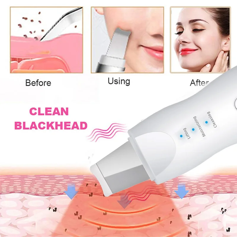 Ultrasonic peeling machine Skin care cleanner Black head exfoliating cleaning device EMS micro current ultrasonic scrubber