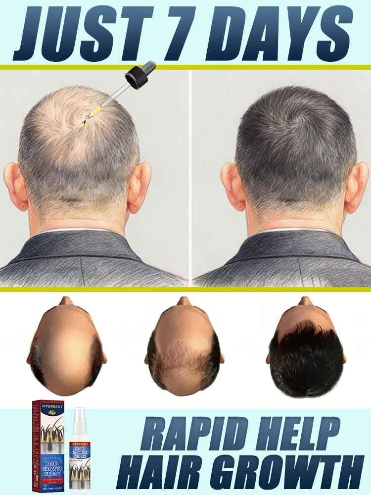 

Addressing the root cause of the problem, ᵃᶜᵗⁱᵛᵃᵗᵉˢ ʰᵃⁱʳ ᵍʳᵒʷᵗʰ ᵃⁿᵈ ᵛᵒˡᵘᵐⁱⁿᵒᵘˢ ʰᵃⁱʳ‧