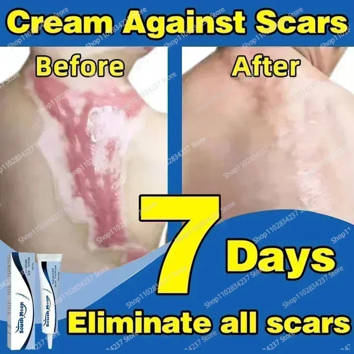 Scar Repair Acne Scar  Remover For Burn Scars Postoperative Scar Removal Skin Smoothing