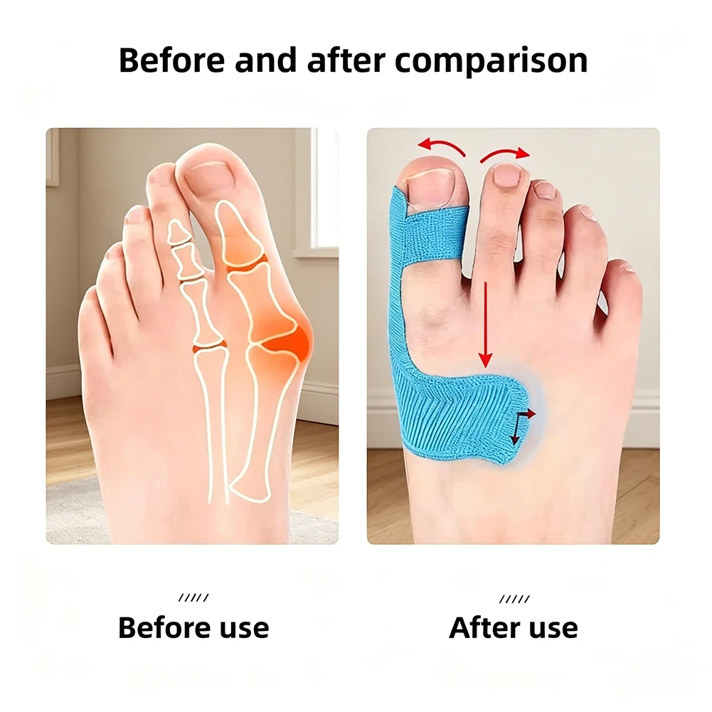 Hallux Valgus Correction Bandage Bunion & Hallux Valgus Support Daily High Heel Walking