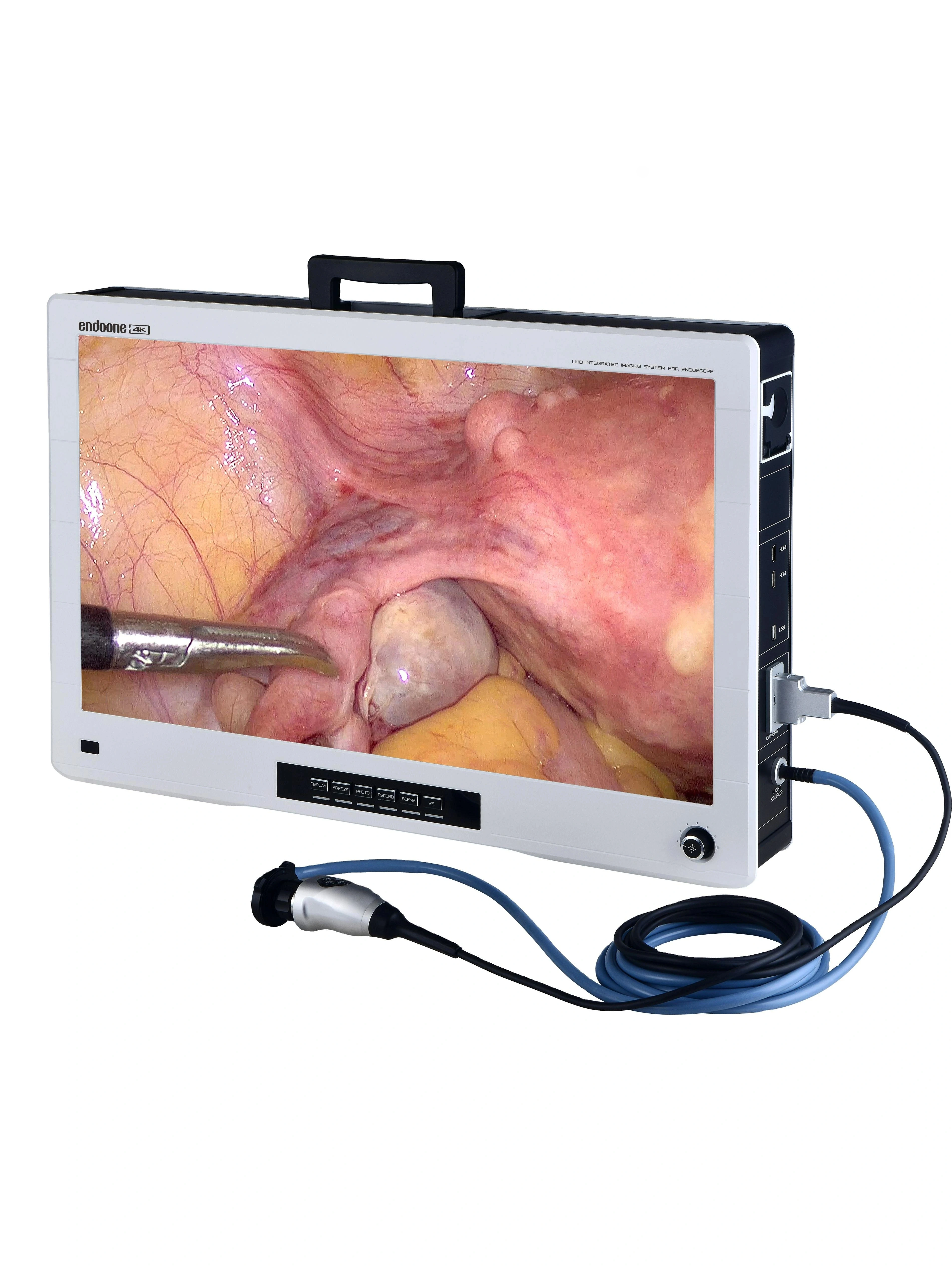 4K  Integrated Medicals Imaging Endoscopes Portable Camera System Ent