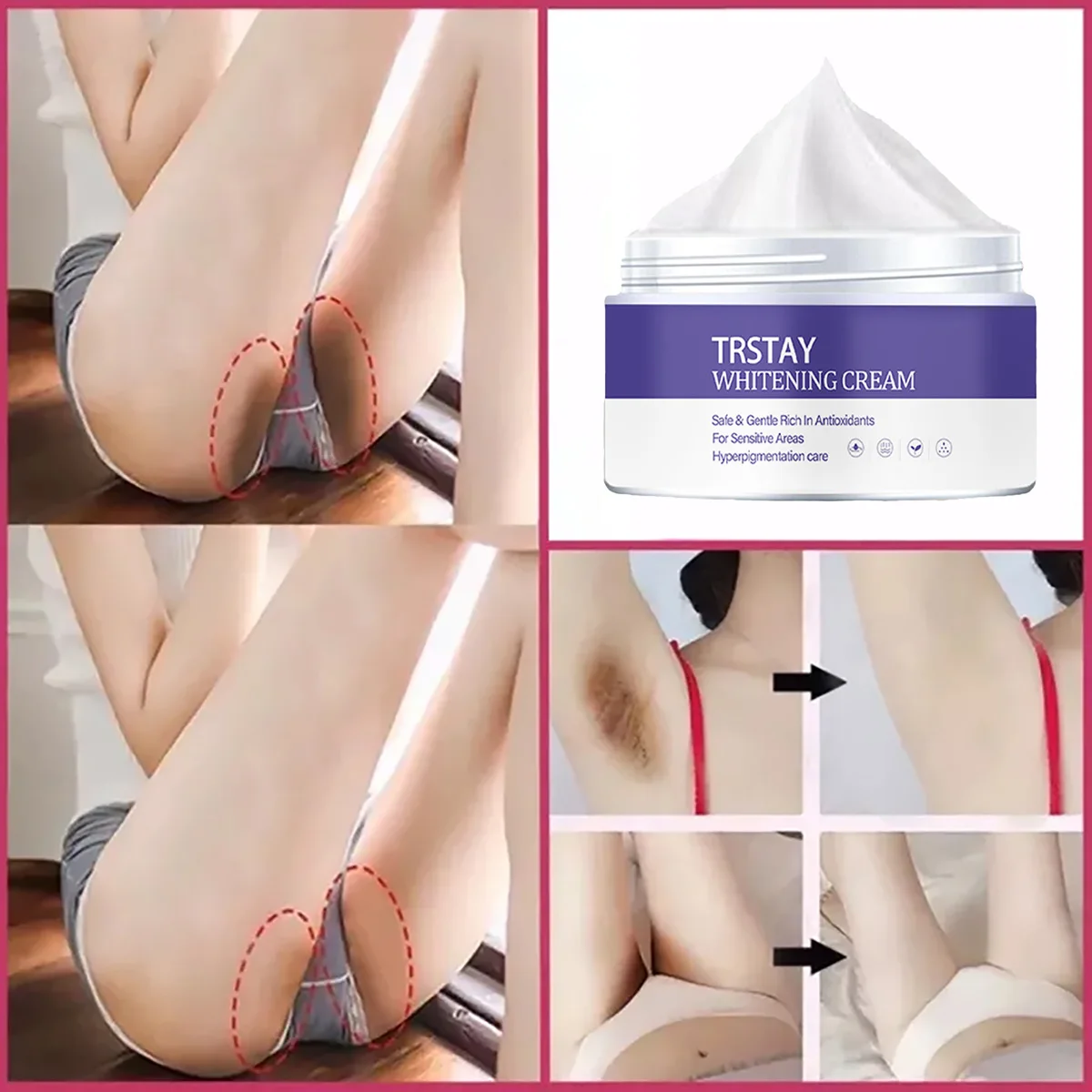 

Отбеливающий крем TRSTAY, нежный антиоксидант, богатый уход за кожей для чувствительных пигментационных зон, крем для тела для мамы и детей