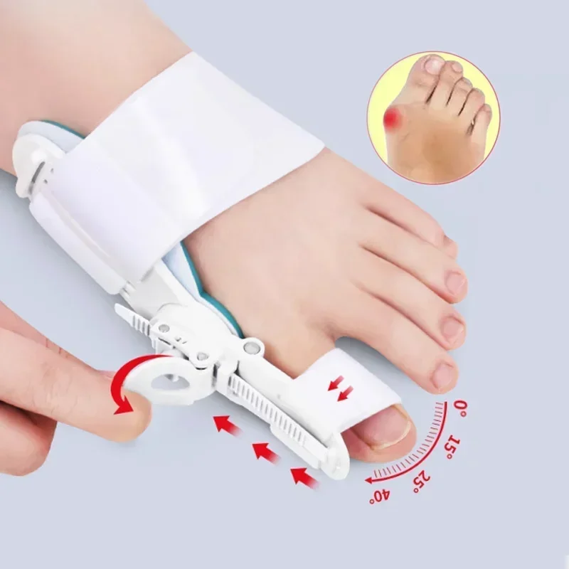 Corrector de Hallux Valgus, separadores de dedos del pie para juanetes, separador Haluksy del dedo del pie, Corrector de juanete, separador de dedos Halux Valgus