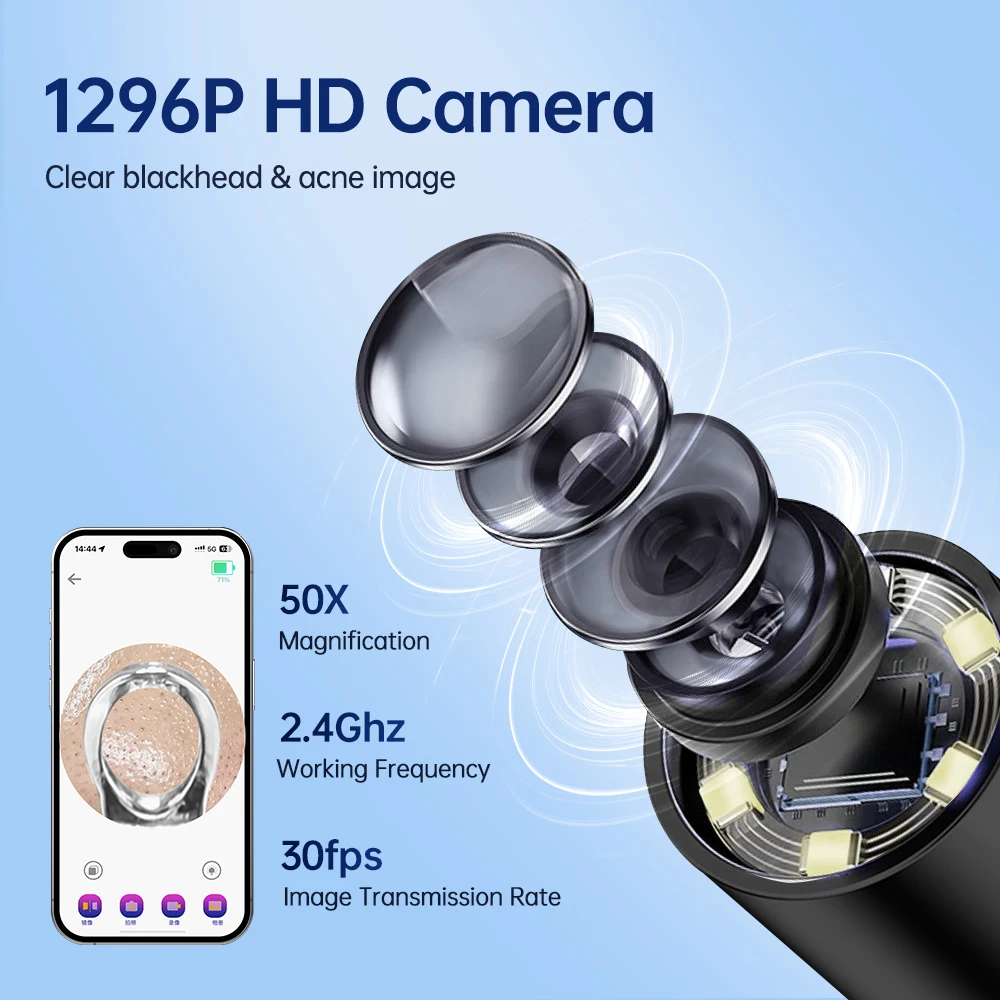 Removedor Visual inteligente de espinillas, cámara HD, aumento de 50X, limpiador de acné y poros 1296P, Kit de herramientas de comedón para limpieza profunda