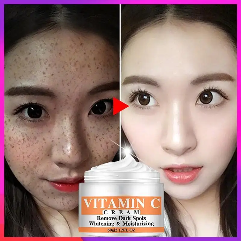 Mais novo vitamina c clareamento creme facial reparação fade sardas remover manchas escuras melanina removedor clareamento creme facial