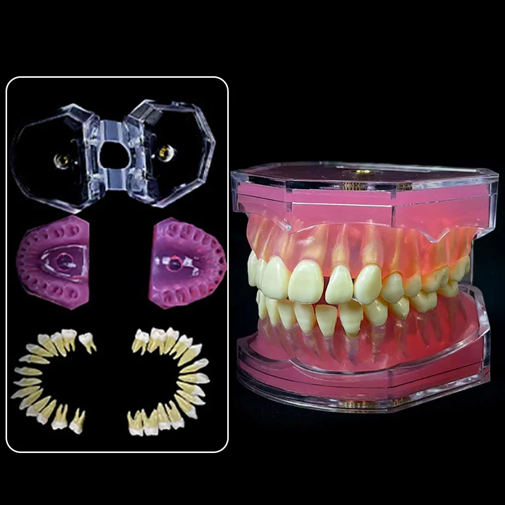 

Dental Model with Removable Teeth Jaw Typodont Soft Gum Adult Standard for Dentistry Teaching and Clinical Demonstration