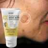 Premium Kojic Acid Brightening Face Cream 1