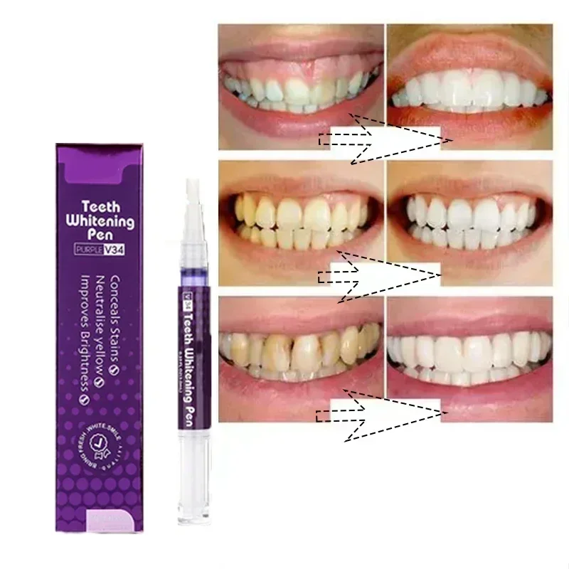 Tooth Whitening Pen Dazzling White Teeth Whitening Pen Instant Teeth Whitening Pen Brighten Tooth Hygiene Care Tools New1