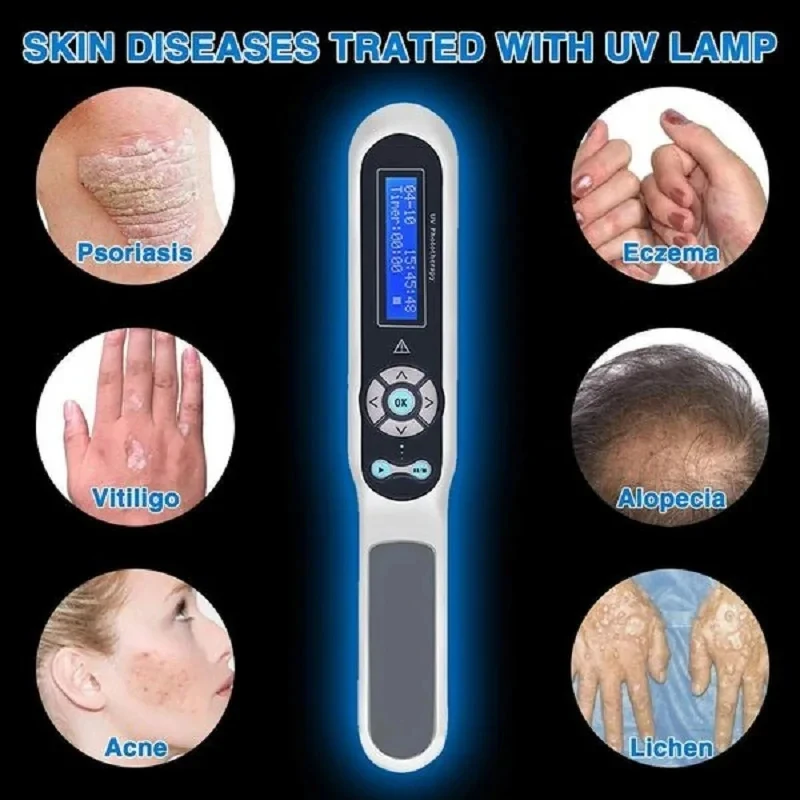 308nm Handheld uvb Light Therapy Portable Effective To Treat vitiligo Psoriasis Eczema Uvb Lamps Uv Phototherapy Instrinstrument