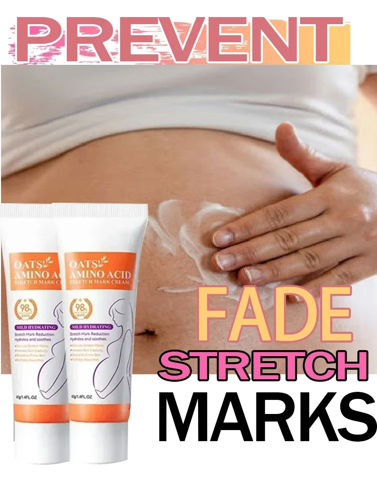 

Stretch Marks Permanent Removal Cream Eliminate Body Belly Stretch Marks Swelling Marks Remove Skin Cracks Repair Firming Care