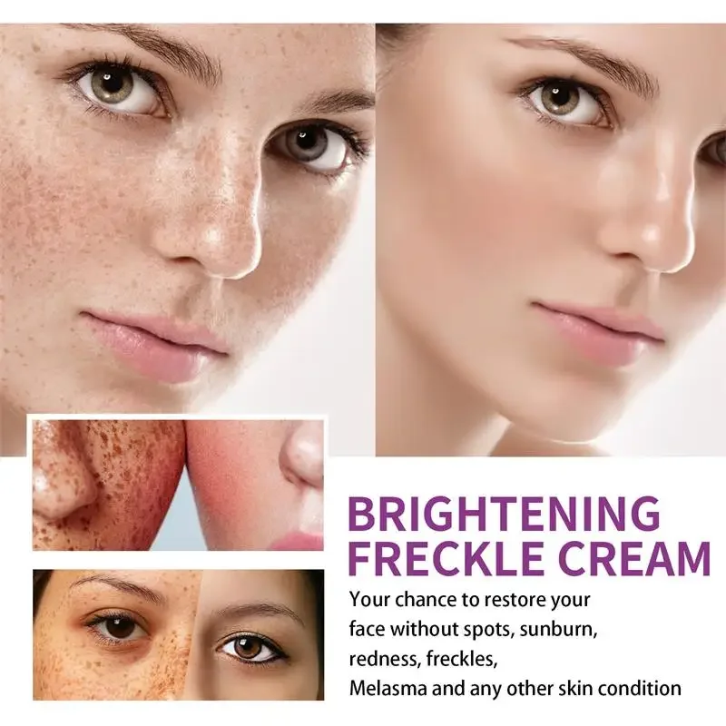 2024 New Niacinamide Whitening Freckle Cream Effectively Removes Melasma Lightens Black Spots Acne Marks Brightens Facial Care