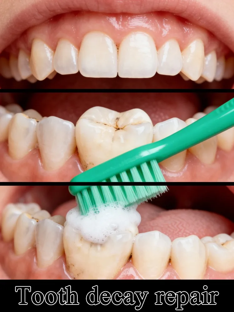 2026 New 4th-Gen Toothpaste: Repairs Gums, Relieves Toothache, Cleans & Whitens – Your All‑In‑One Dental Solution
