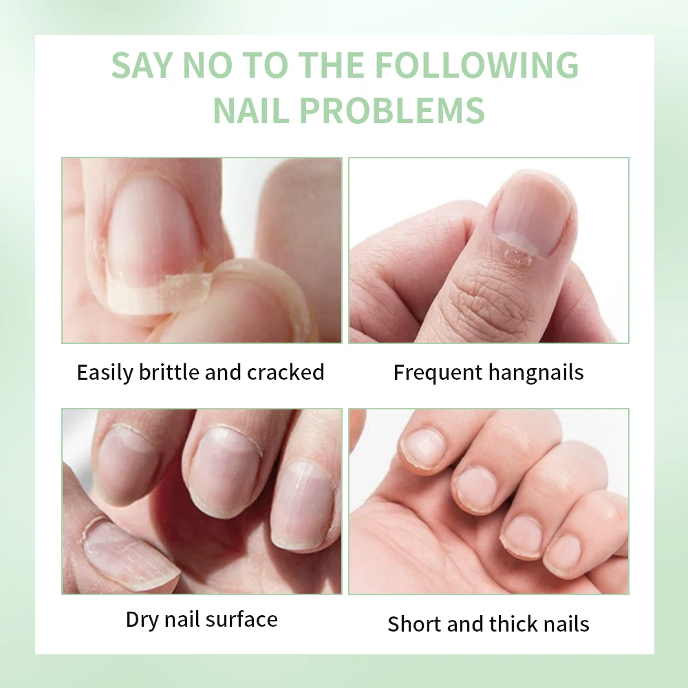 Nail Treat-Growth Cuticle Oil Bright Oil Texture Repair Damaged Nail Surface Strengthen Moisturize Growth Shine Nail Cuticle Oil