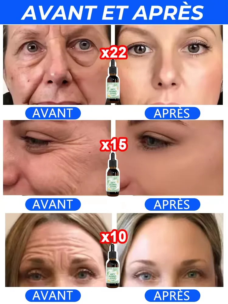 دافئ وخالي من التجاعيد في عام 2025. جلد كامل الجسم، يجلب نفسه إلى سن 18 عامًا