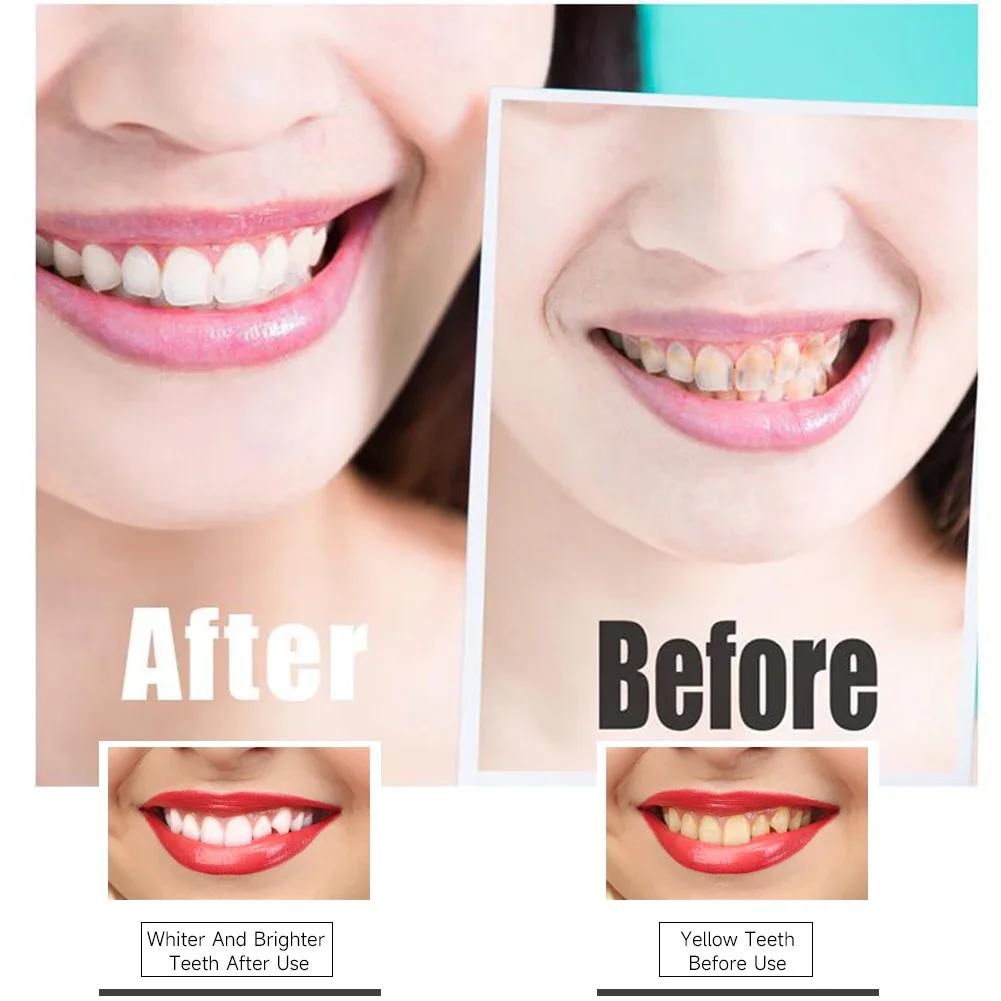 Newest PAP Charcoal Gel Teeth Whitening Strips Activated Bamboo Dental Veneers Tooth Bleaching Stain Removal Oral Hygiene Care