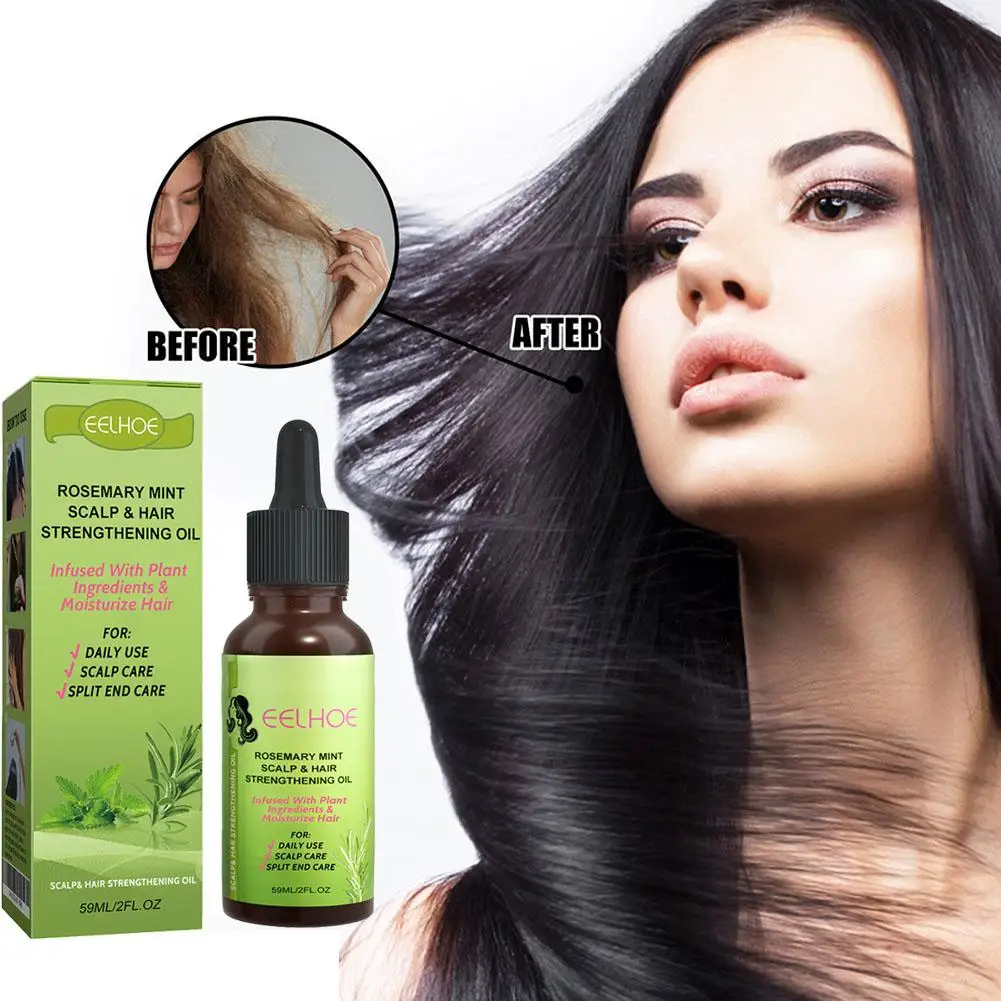 Solución de Nutrición del cabello de menta para calmar el cabello seco, masaje del cuero cabelludo, tratamiento para fortalecer el cuidado del cabello, aceite esencial M3K5