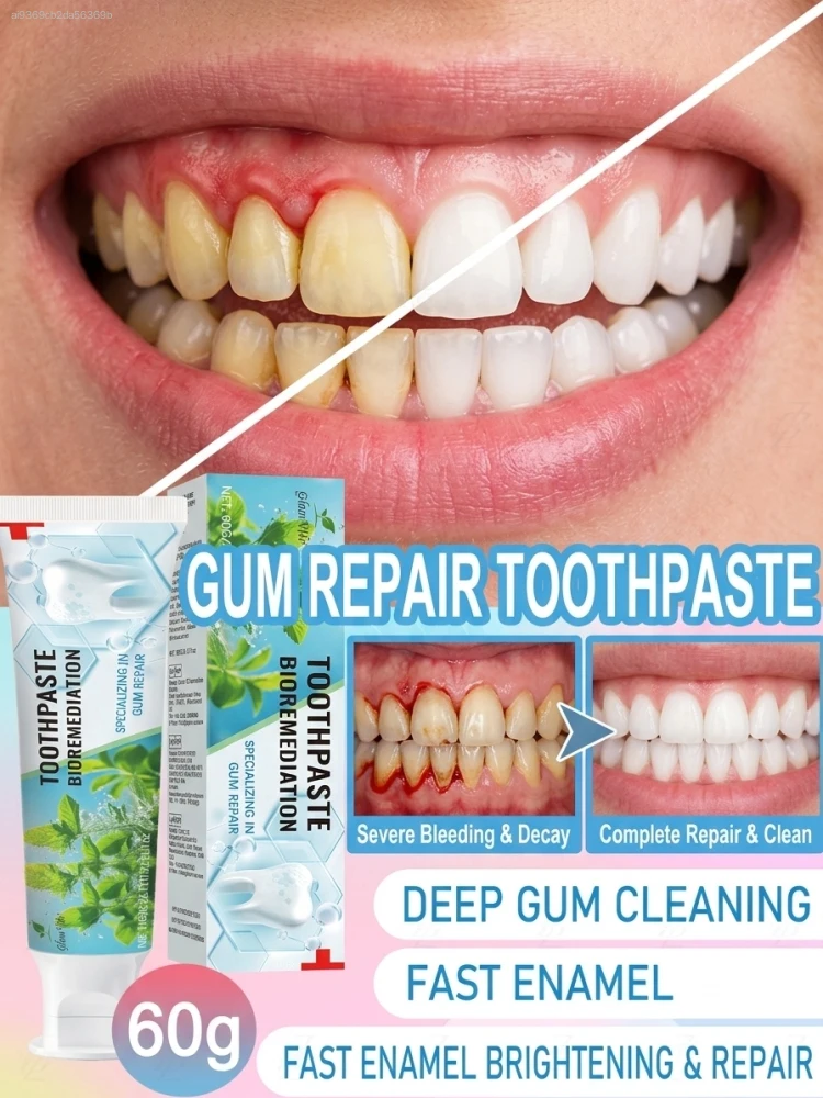 Intensive Probiotic Gum Treatment  – Relieves Swollen Bleeding Gums, Soothes Sensitive Teeth, Whitening & Stain Remover, Anti-Bad Breath with Long-Lasting Freshness, Deep Oral Cleaning Hygiene Paste for Adult Care, 60g